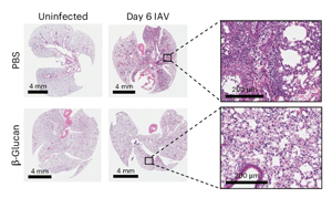 Nature Immunology:重新平衡免疫系統