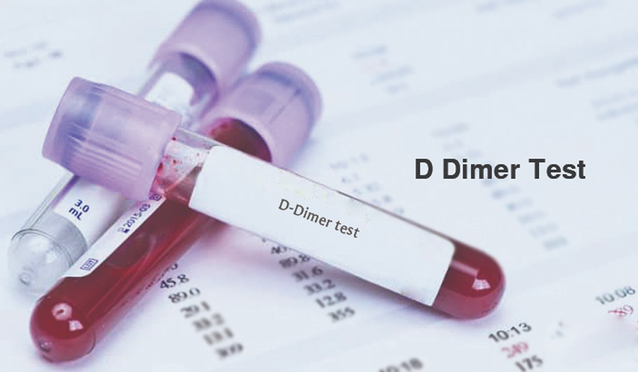 D-Dimer檢測 D-Dimer檢測