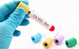糖鏈抗原15-3(CA15-3)-磁微粒化學發(fā)光(吖啶酯)解決方案
