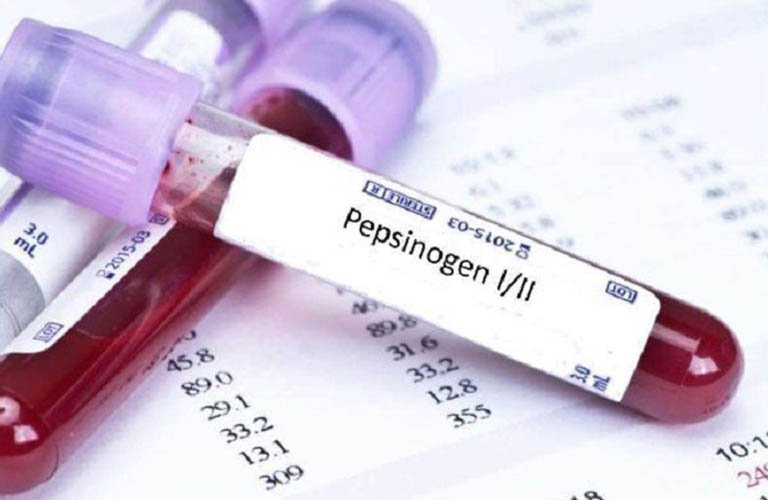 胃蛋白酶原I(PGI)檢測 胃蛋白酶原I(PGI)檢測
